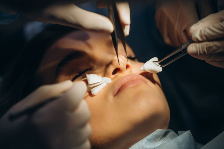 How to Choose the Right Plastic Surgeon for Rhinoplasty