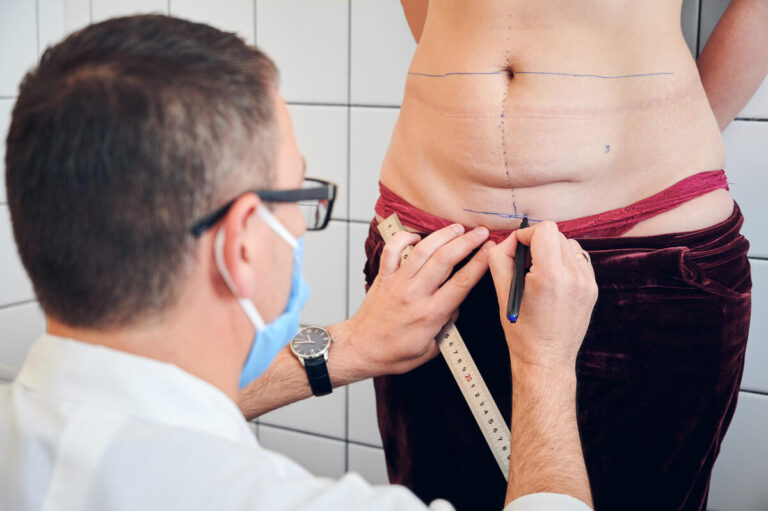 How to Choose the Right Plastic Surgeon for Tummy Tuck Treatment